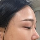 에이치래쉬 이미지