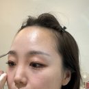 르네드보떼