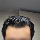 제이제이광고 | [탈모 앰플 추천] 제이제이 스칼프 앰플 내돈내산 후기, 정수리 열감 관리까지