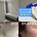 (주)부강시너지 | 천안 성성동 피부과 여드름관리 6회 내돈내산 관리 일주일후 여드름 0개 리얼후기