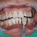 하나로치과기공소 이미지