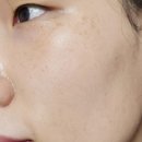 바른공방 | 아담공방 글루타치온앰플 2주사용 솔직후기 과연...?