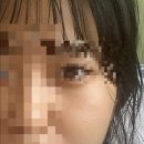 프로젝트유의원 | [내돈내산] #1 리쥬란힐러 인생첫경험, 피부과시술 추천, 정보, 가격공유