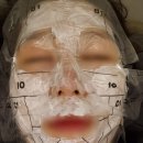 연세리즈의원 이미지