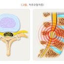 정직한신경외과의원 네이버블로그