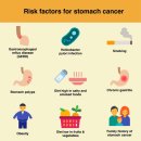 연세선경의원 | 위암이란 무엇인가