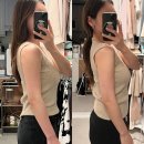 닥터봄춘의원 | 닥터손유나의원 매직팔뚝캣 복합지방파괴레이저1회차 효과 후기