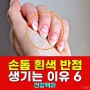 하얀손톱