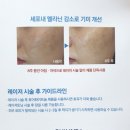 (주)레비레스코 | 스킨엠디 레비레스코 퓨어화이트놀세럼으로 기미잡티제거 좀 해볼까?