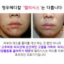 줌메디칼 이미지