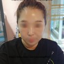 오늘, The 빛나