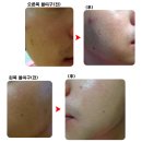 [차앤박] 화이트 필 (필링 토탈 프로그램-2주차) 남자가 쓰면 더 좋아요^ㅂ^