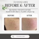 아이비에스테틱 이미지