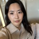 여우야뷰티카페 | 신사동 실리프팅 후기 실루엣소프트 리얼 붓기•가격은? 1주 차 변화 & 압구정로데오피부과 방문기