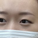 브로피시 이미지