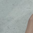 25시비디오 | 눈밑 아이리쥬란 내돈내산 시술 후기 비용 효과 눈가주름 개선
