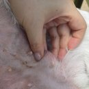 6월 18일 코비 탈장 의료기록 이미지