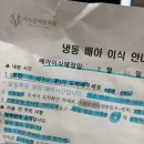 대구 미라클여성의원 동결2차 5일배아 2개 이식 후기