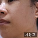 은혁글로벌 - 44727 | 에센셜 마스크팩 두 가지 비교! 환절기 피부케어에 딱인 마데카소사이드 vs 로제 PDRN 솔직 사용 후기