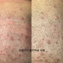 그레이카서비스 | 두피문신 전문 서비스 - 인천, 그레이시티, 김포, 송도, 부천 지역