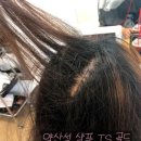 6-325 TS | 머리 하루만에 기름지는 이유? 두피 살리는 약산성 샴푸 추천 &amp; 사용후기