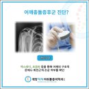 계양척척마취통증의학과의원 네이버블로그