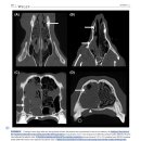 CT 상 비강 내 grass awn에 의한 rhinitis와 non-foreign body rhinitis의 감별 이미지