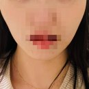 이로운에스테틱 | 윤곽 관리 후기, 신중동 이로운에스테틱