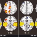 원영상의학과의원(The One MRI Clinic) | 마음훈련이 뇌를 젊게 만들어