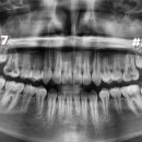 수원탑플란트치과의원 이미지