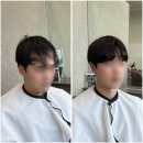 블랭크컨설팅 | 양재역근처 20대 숱없는 앞머리 탈모 블랭크유 증모술 후기