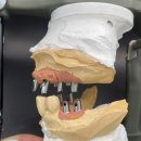 커스텀기공소 이미지