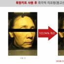 에이써치 이미지