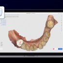 애플치과기공소 이미지