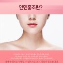 리멤버피부과강서 이미지