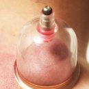 보명한의원 이미지