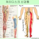 누구에게나 쉽게 설명하고 누구나 쉽게 치료할 수 있는 통증 맵 이미지