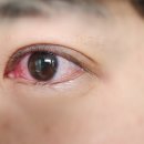 진해안과의원 이미지