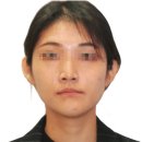 서울미소드림치과의원 | 안면비대칭교정기 하나면 양악 시술 200%효과