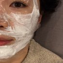 부산 서면피부과 리쥬란힐러 손주사 효과 :: 7일차 솔직후기