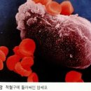 황제 쑥뜸 이미지