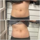 민들레 약국 | 복부 다이어트 영양제 우먼정 내돈내산 후기, 식전 루틴으로 먹어본 변화