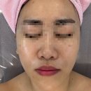 서산피부관리 피부아지트뉴페이스 맞춤 관리(미백) 받은 후기