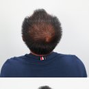 리게인프로젝트전주 이미지