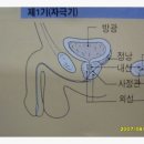 전립선 비대증.. 이미지