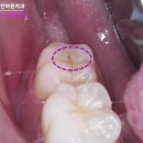 송탄바른치과의원 이미지