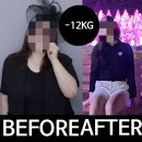 서울S한의원 | 압구정역한의원 마운자로후기 12KG 감량 효과