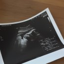 행복양품 | [임신일기 05] 임신 35주~출산 전까지 임신 후기 기록