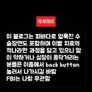 세기치과기공소 | 앞니 치료의 한계, 문제는 치아가 맞능가? 풍치 앞니 블랙트라이앵글 치료