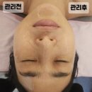 수얀스킨케어